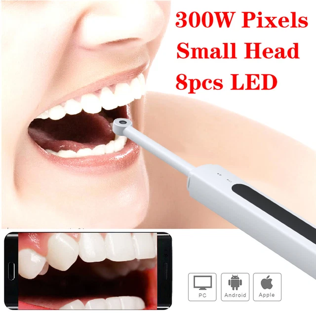 New Dental USB Intraoral Camera Oral Endoscope Digital Imaging Intra Oral IP56