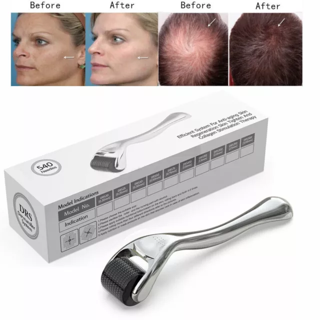 540 Titanium Micro Derma Roller 1.0 mm für Aknenarben, Falten, Bart, Haarausfall