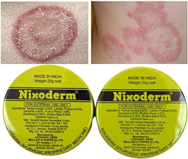 Crème Nixoderm - Traitement Infections Cutanées, Eczéma, Boutons, Peau à Problèmes 20g