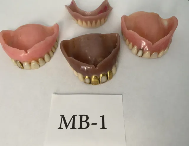 Vintage Denture Lot With Gold Teeth Upper Dentures