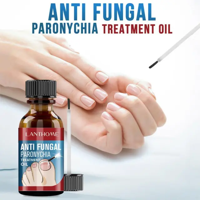 Nail Repair Liquid Toenail Fingernail Anti-Fungal Fungus Treatmentau S4Q6