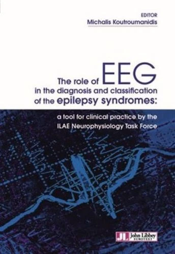 ROLE OF EEG In The Diagnosis And Classification Of The Epilepsy ...
