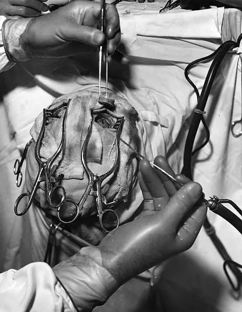 Vintage Lobotomy Photo 490b Oddleys Strange & Bizarre