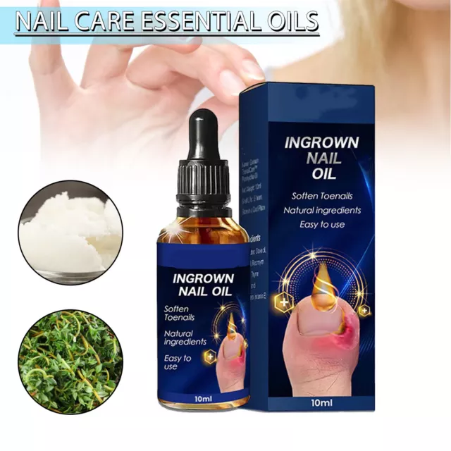 Cedarwood Oil for Hair it's Usage and Benefits for Hair Growth