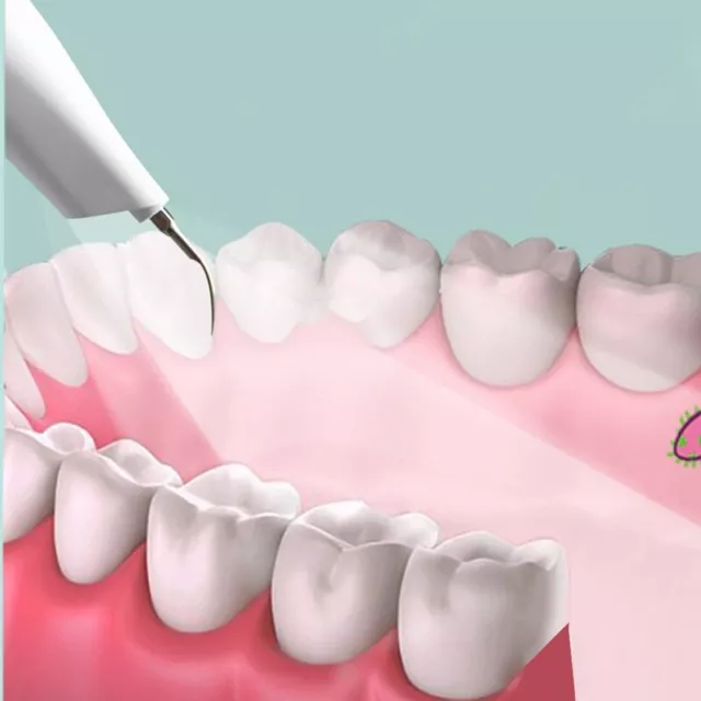 Zahnsteinentferner Ultraschall Elektrisch Zahnreinigung Set für Menschen Hunde 3