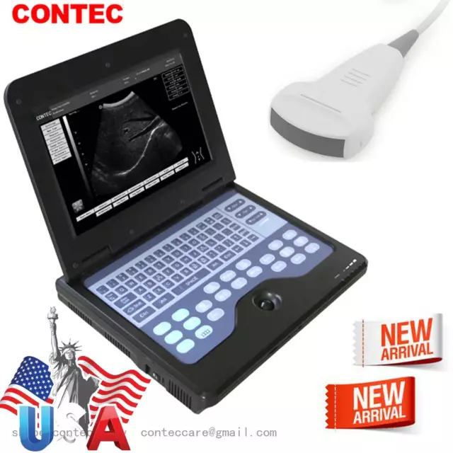 FDA CECMS600P2 Portable Ultrasound Scanner Digital Laptop Machine,3.5Mhz Convex