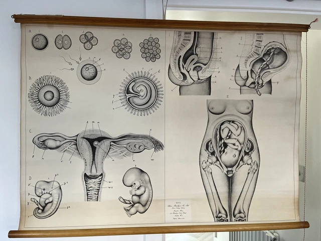 ANTIQUE VINTAGE ADAM Rouilly Wall Chart Poster Medical Fertilisation ...