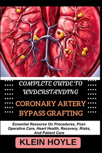 COMPLETE GUIDE TO Understanding Coronary Artery Bypass Grafting ...