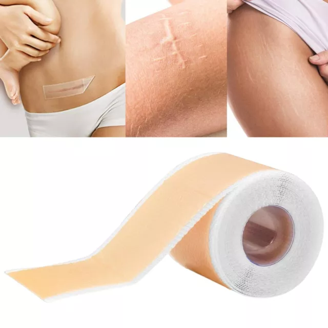 Silicone Scar Sheet for Scar Removal, Scar Away Patch, Scar Sheets, Keloid Bump