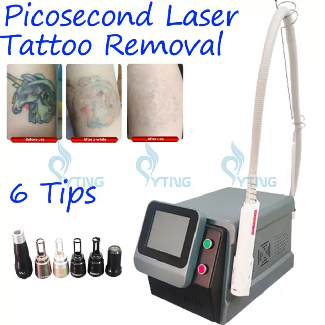 2024 picosecond Nd Yag Laser Tattoo Removal Machine Pigment remover noninvasive