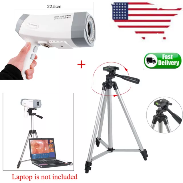 Portable Digital Video Electronic Colposcope 480000 Pixels Color Camera Tripod