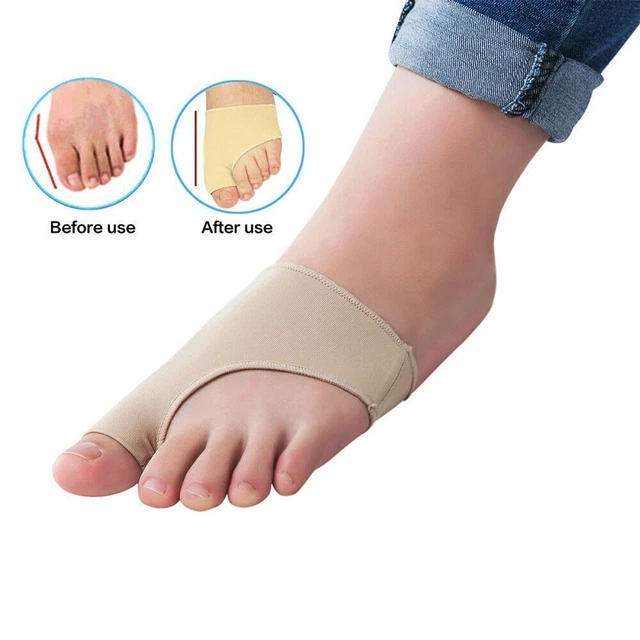 Tutore elastico per alluce valgo 509 Otto Bock dolore alluce