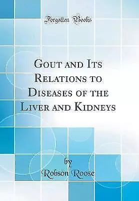 Gout and Its Relations to Diseases of the Liver an