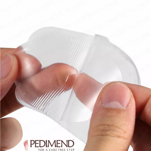 Pedimend™ 2x Supination and Pronation Corrective Heel Insoles for O/X Type Legs 3