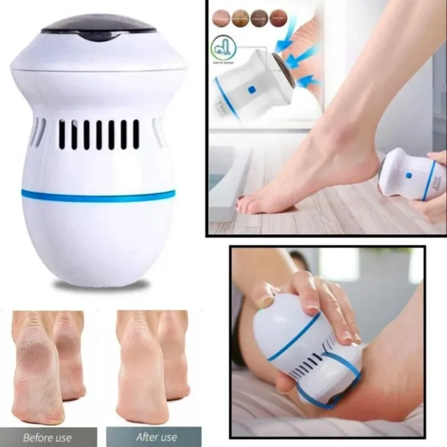 Foot Pedicure Grinder Remover Tool Automatic Polisher Dead Skin Callus Feet Care