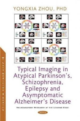 Typical Imaging In Atypical Parkinson S Schizophrenia Epilepsy And Typical Imaging In Atypical Parkinson S Schizophrenia Epilepsy And