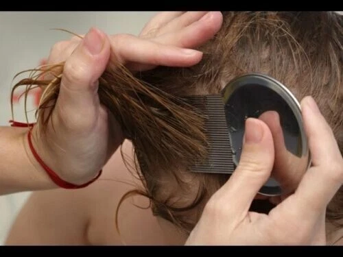 Nitty Gritty Anti-Lice Nit Comb Head Lice Treatment Stainless Steel Metal Comb 3