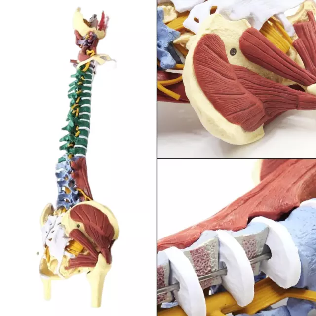 Flexible Spine Model Lumbar Column Model Anatomical Model for Exhibition