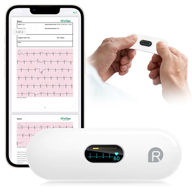 Wellue Moniteur ECG Surveillance 30s-5 min OLED Moniteur de Fréquence Cardiaque