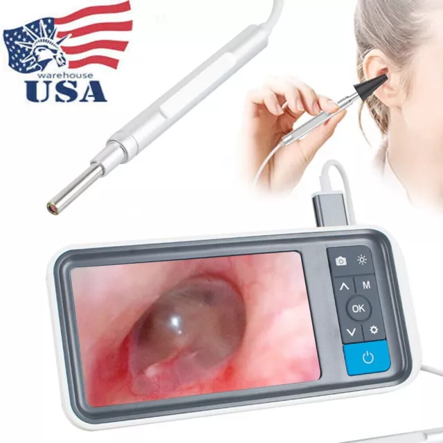 Otoscopio digital 4,5 pulgadas 1080P HD LCD pantalla LCD mira para oído endoscopio oído visual EE. UU.