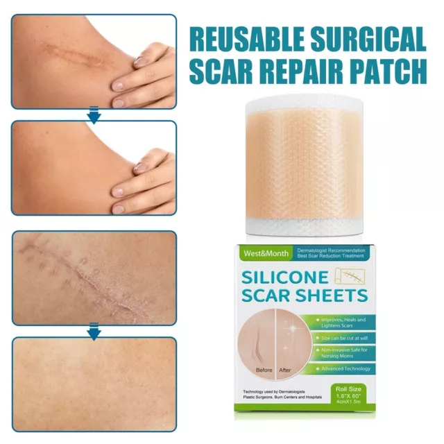 Nastro trattamento riparazione pelle autoadesivo foglio gel di silicone rimozione cicatrici