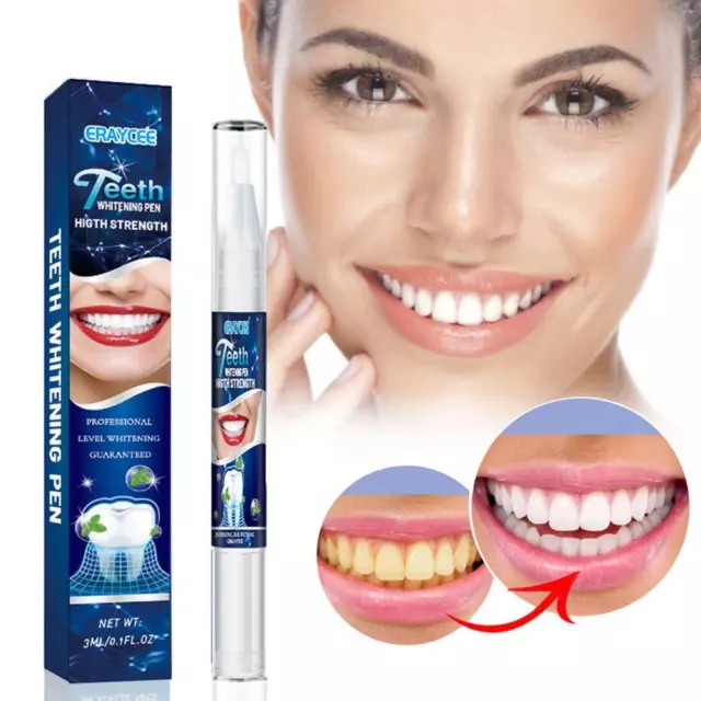 1/3× Teeth Whitening Pen Extra Strong White Hygiene Tooth Stain Removal.AU