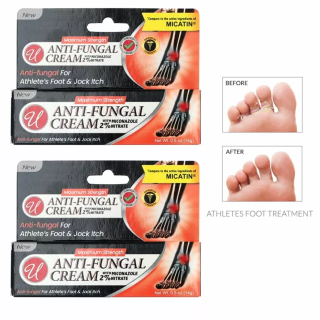 2 Miconazole Nitrate 2% 0.5 Oz Antifungal Cream Athletes Foot Jock Itch Itching