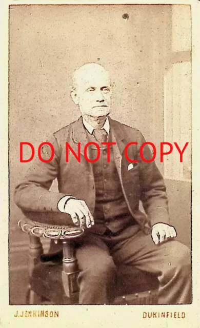 CDV Card Bald Man Photograph J.Jenkinson Dukinfield (966)