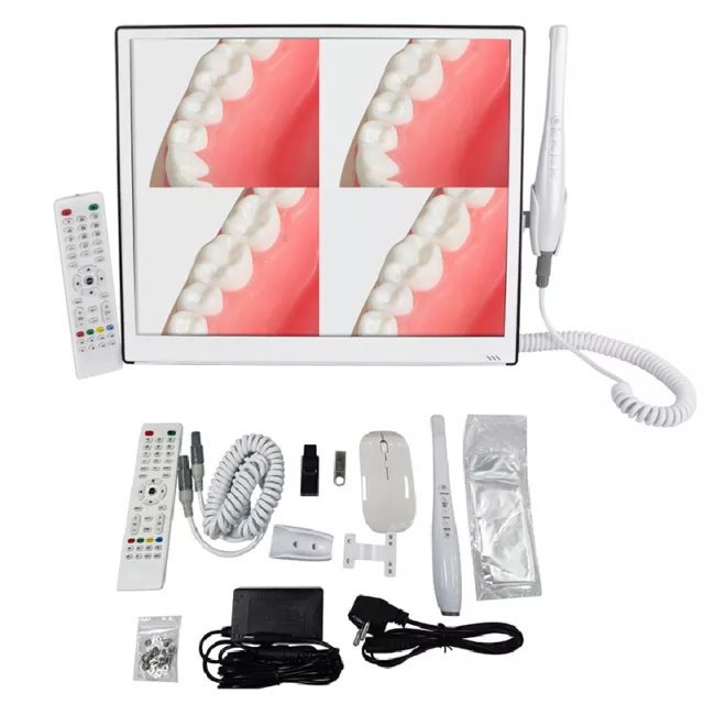 17 Inch High-Definition Digital LCD AIO Monitor Dental Intra oral Camera CMOS1/4