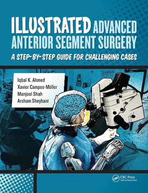 ILLUSTRATED ADVANCED ANTERIOR Segment Surgery: A Step-by-Step Guide for ...
