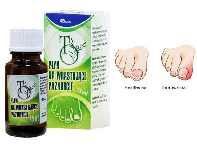 TO Nail Iiquid para uñas encarnadas 15 ml