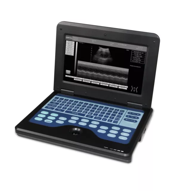 CMS600P2 Portable Laptop Ultrasound Scanner Machine + Cardiac probe USA Stock