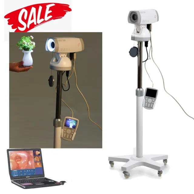 Medical Camera 830,000 Pixels CCD + Digital Video Electronic Colposcope FDA