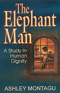 The Elephant Man A Study in Human Dignity, Ashley