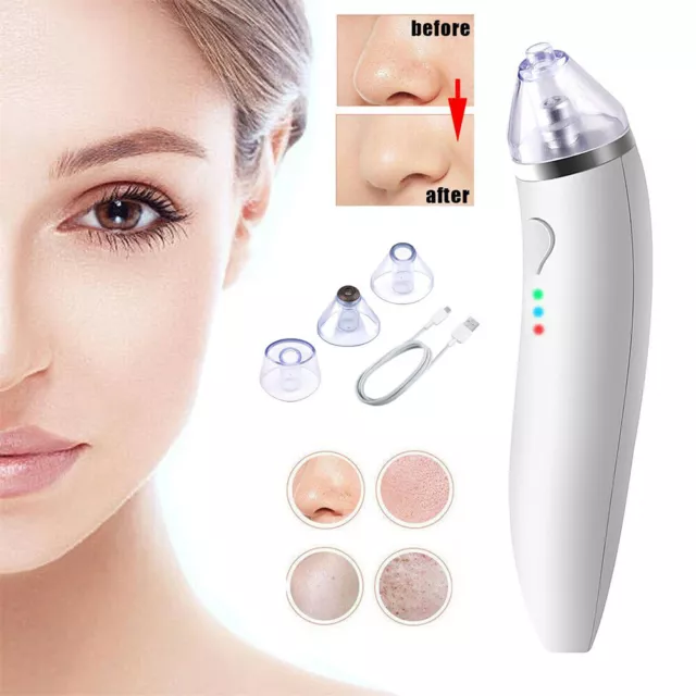 Electric Blackhead Remover Face Pore Vacuum Suction Acne Dot Facial Skin Cleaner