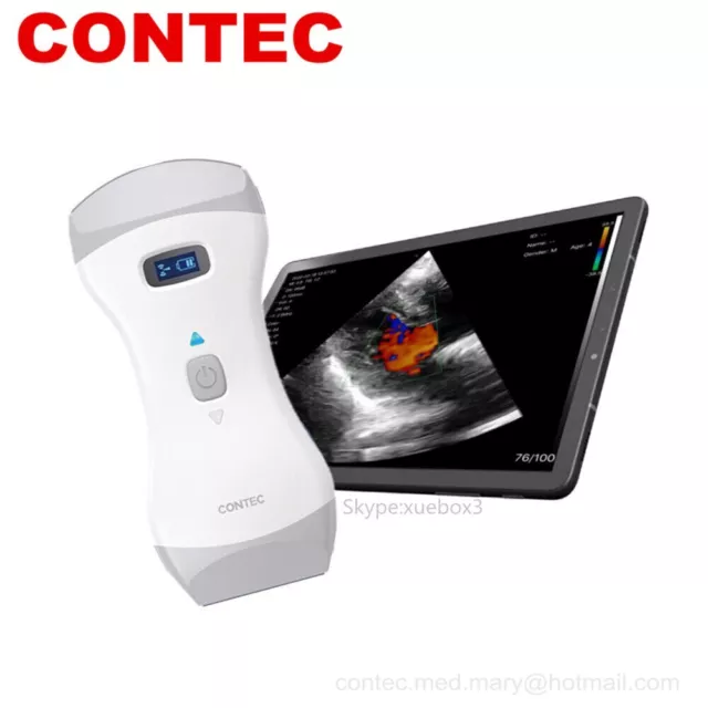 handheld Wireless Color Doppler Ultrasound Scanner WiFi,Convex&Linear Probe NEW