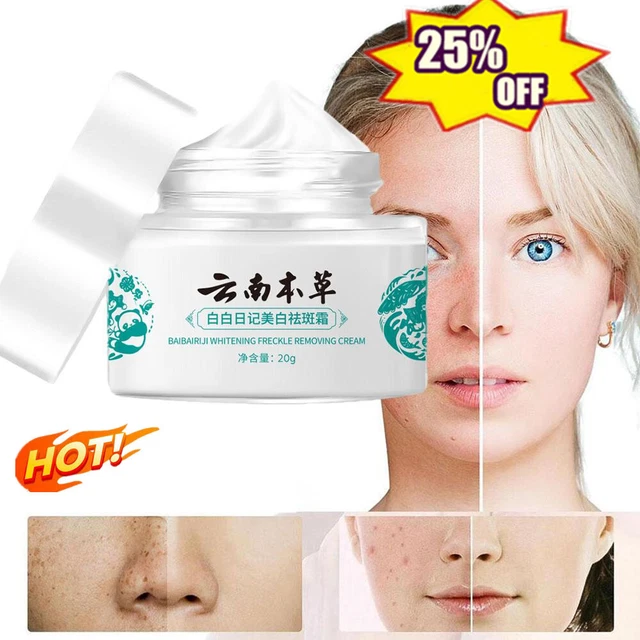 20g Whitening Spot Lightening Cream, Japanese Melasma Cream, Yunnan Herbal Cream