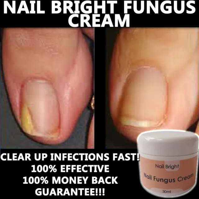 Nail Bright Nail Fungus Cream Healthy Strong Manicured Nails Works Fast !