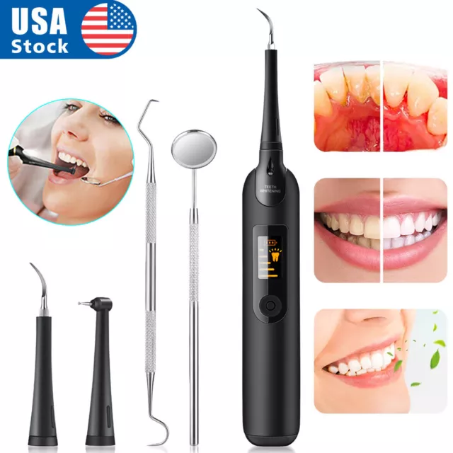 Ultrasonic Cleaning Tooth Calculus Dental Plaque Stain Remover Teeth Cleaner Kit Ultrasonic Cleaning Tooth Calculus Dental Plaque Stain Remover Teeth Cleaner Kit