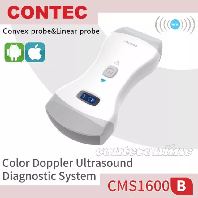 Ultrasound Scanner Color Doppler Double Heads Convex Linear Probe，Android, IOS