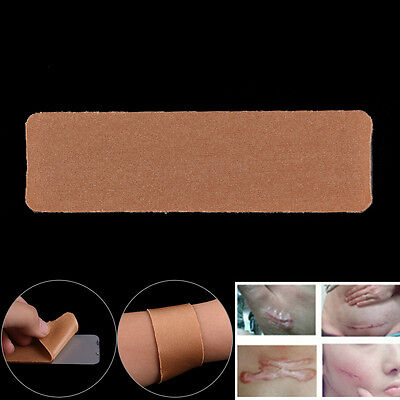Parche de silicio reutilizable para eliminar cicatrices desnudas eliminar quemaduras traumáticas acné gel reparación de la piel YB