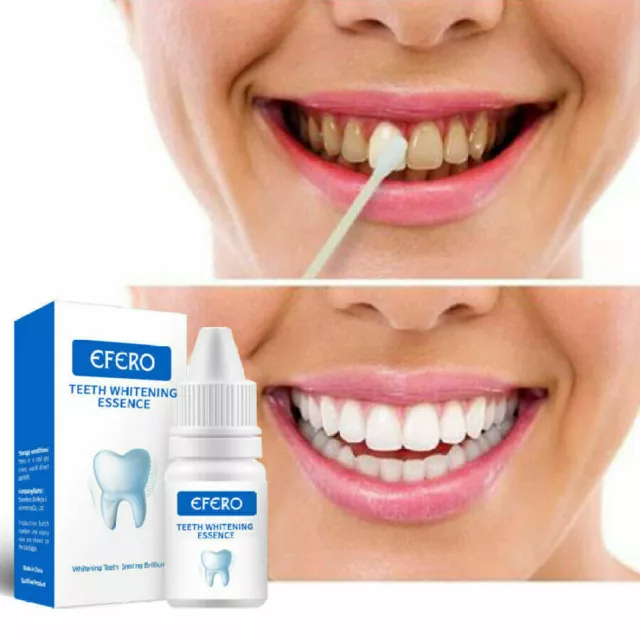 Gel Para Blanquear Los Dientes Elimina Las Manchas Y Placa Lucir Dientes Blancos