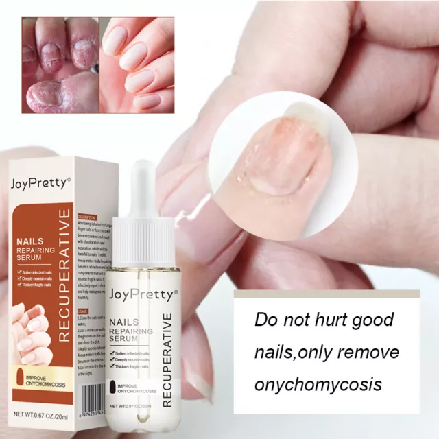 7 Tage Nagel Wachstum Und Stärkung Serum Liquid Nagel Reparatur Nagel Care