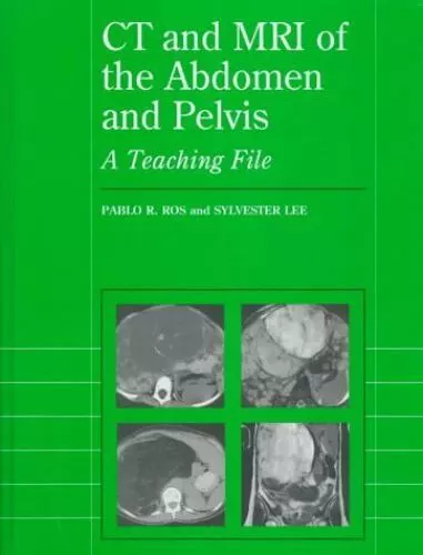 CT and MRI of the Abdomen and Pelvis: A Teaching File by Ros, Pablo R.