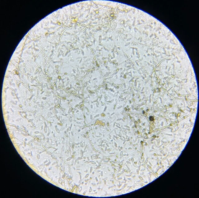 19th c J.D. Moller Microscope Slide Diatom Rugen Germany Mastogloia Braunii Grun