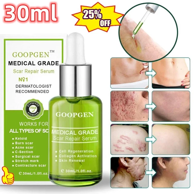 Advanced Scar Repair Serum, Medical Grade Scar Repair Serum