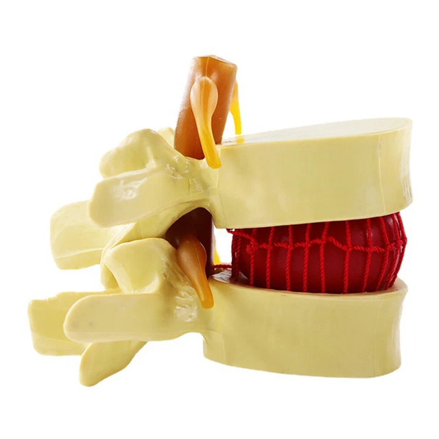 Disc In Human Body LUMBAR VERTEBRAL SPINE Model Column Intervertebral Disc Human Body £19. ...