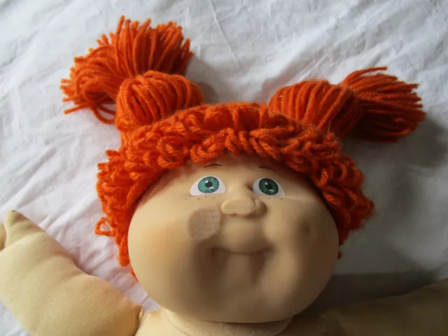 Jesmar Cabbage Patch Doll Red Pigtails Green Eyes Freckles Wounded