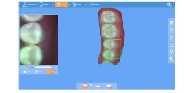 dental intraoral scanner 3D Scan Dentistry Dental labs 2