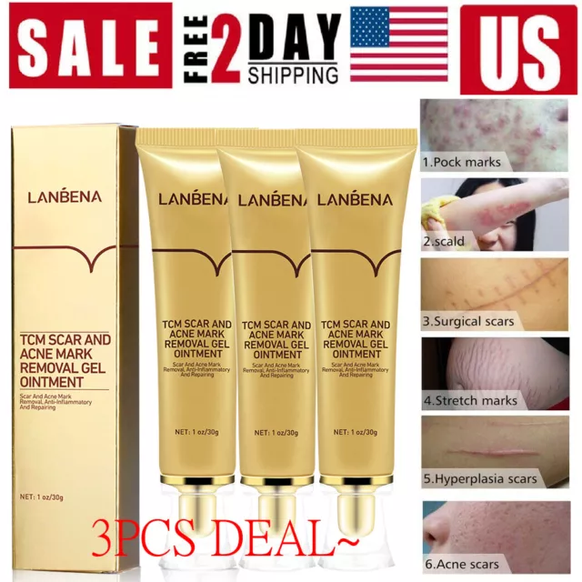 3 Pack Lanbena TCM Pimple Scar and Acne Mark Spots Removal Ointment Gel USA